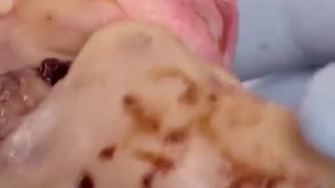 WARNING: Horrible Graphic Pictures…