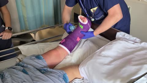 Putting spacers in a cast after foot reconstruction surgery