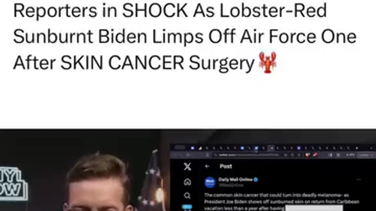 Reporters in SHOCK As Lobster-Red Sunburnt Biden Limps Off Air Force One After SKIN CANCER Surgery