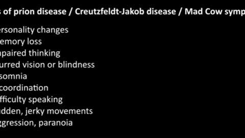 Interview about Prion Disease AKA Mad Cow Disease could be a side effect from the vaccine