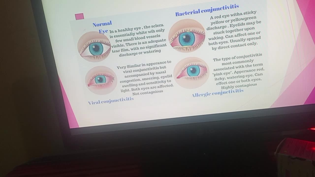 A presentation on eye flu (pink eye)