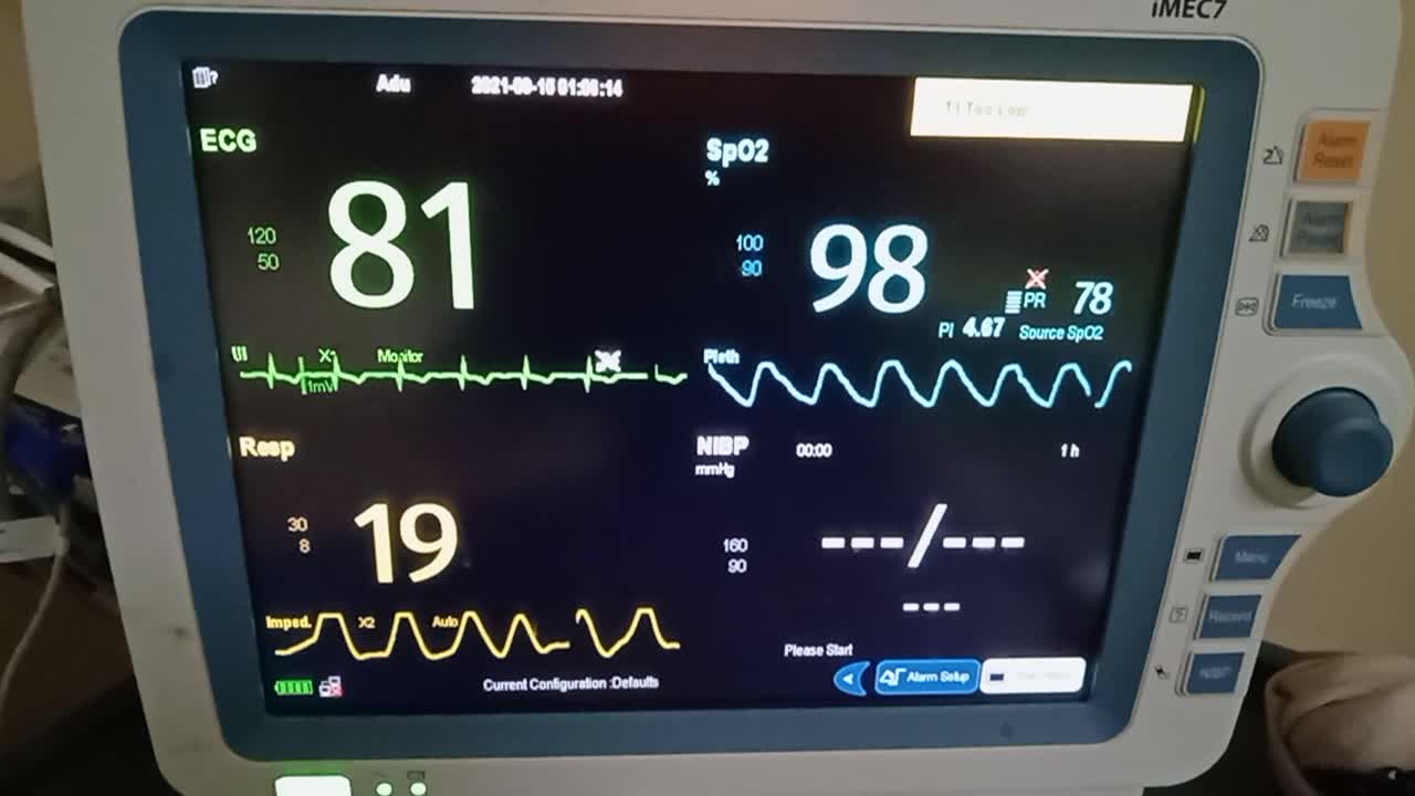 I hope this ecg monitor is fine