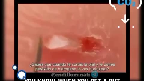 𝗛𝗬𝗗𝗥𝗢𝗚𝗘𝗡 𝗣𝗘𝗥𝗢𝗫𝗜𝗗𝗘 FOR YOUR HEALTH ✅ Important video - Share!