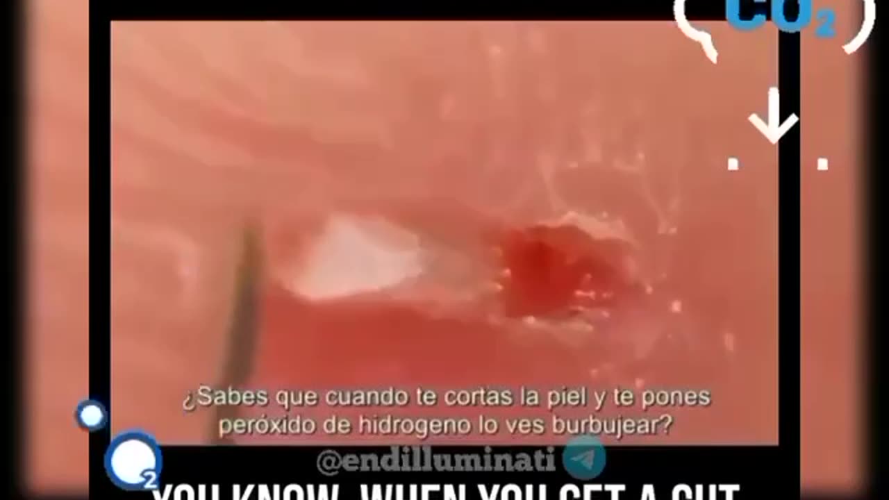 𝗛𝗬𝗗𝗥𝗢𝗚𝗘𝗡 𝗣𝗘𝗥𝗢𝗫𝗜𝗗𝗘 FOR YOUR HEALTH ✅ Important video - Share!