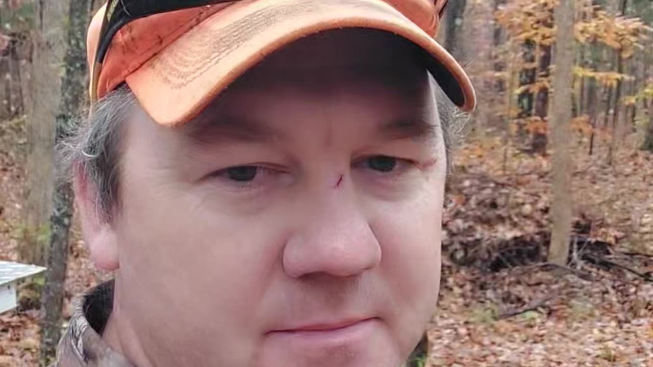 Deer on the brain, can cost you.