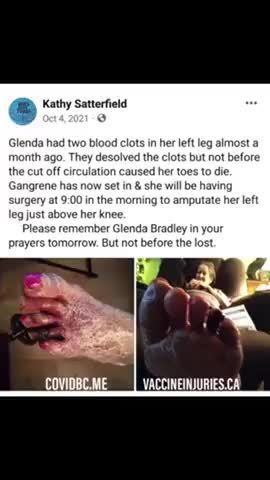 TAKES A LADY IN A WHEELCHAIR TO GET VACCINATED...NOW THE LADY NEEDS AN AMPUTATION