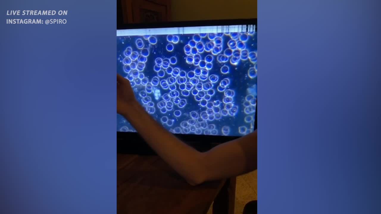 VACCINATED BLOOD VS UNVACCINATED BLOOD