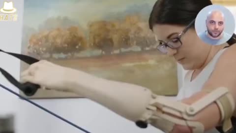 THE FUSION OF ROBOTIC BIONICS WITH THE HUMAN BODY