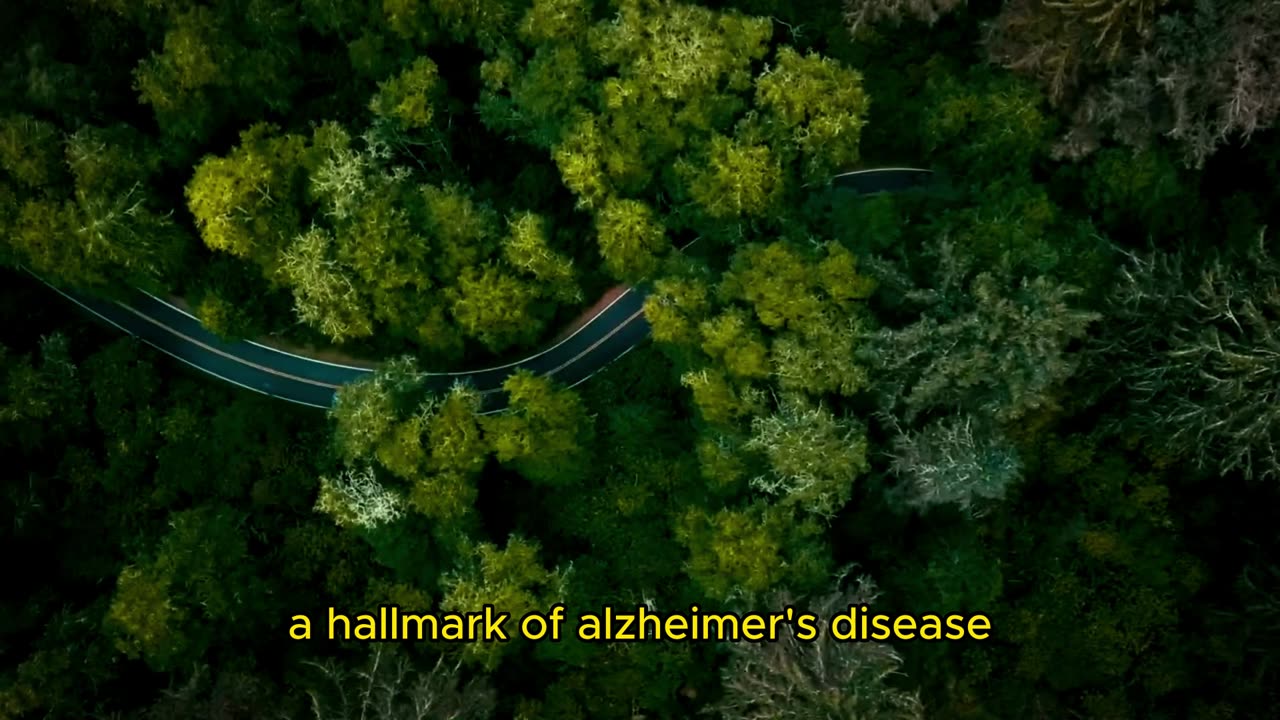 Can Resistance Training Delay Alzheimer's Symptoms?