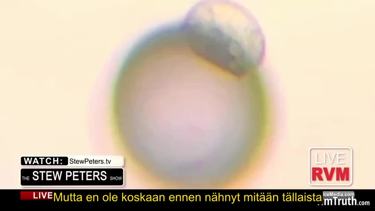 HYDRA VULGARIS ON ELÄVÄ OLENTO ROKOTTEEN SISÄLLÄ - Se on kuolematon
