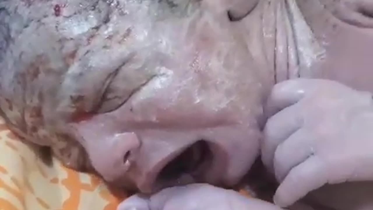 Big_Vermix_On_Body_Of_The_Baby_After_Birth_.Female_Staff_Clean_the_Baby_With_Oil_