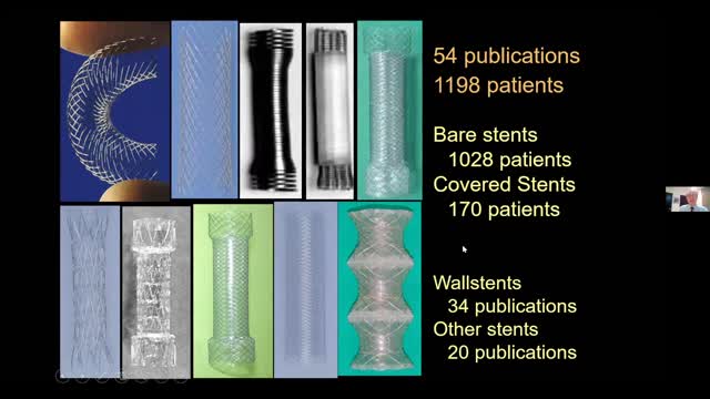 No. 14. Colocacion de Stents en el Estómago Qx alterado/Rol de la RI en Estrecheces Colorectales