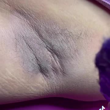 @nanis__aesthetics Performs underarm wax with Purple Seduction #hardwax #underarmwax #armpitwaxing