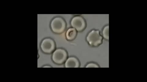 A Theory About Cancer and Parasites