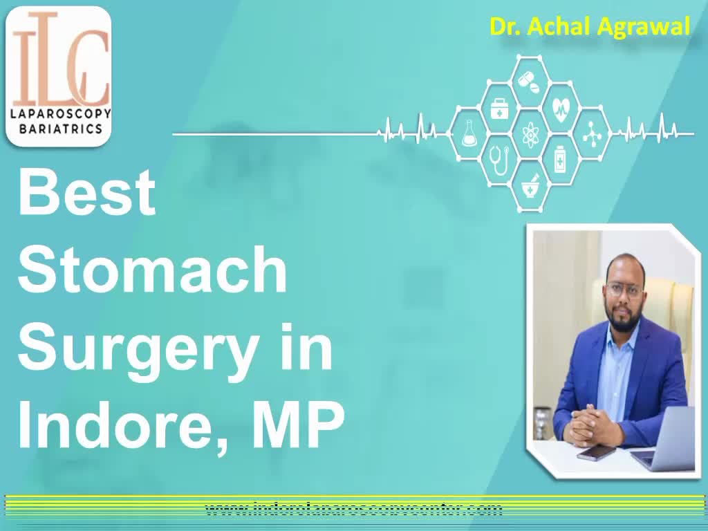 Best Stomach Surgery in Indore, MP | Dr. Achal Agrawal