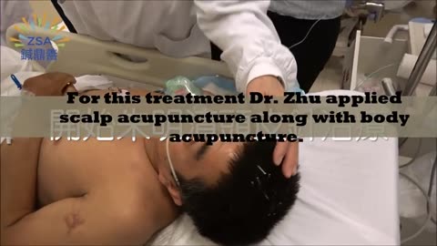 Zhu Scalp Acupuncture - Post Stroke