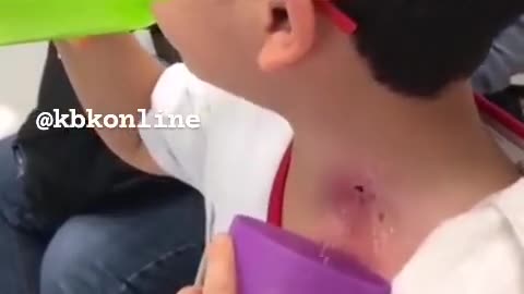 Hole In His Neck