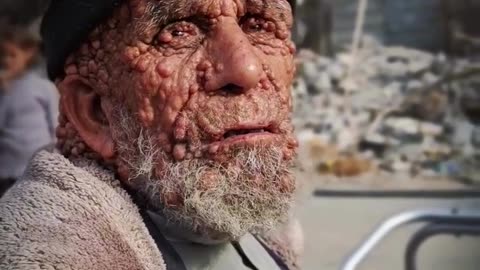 Abu Saber is an elderly man who lost his entire home