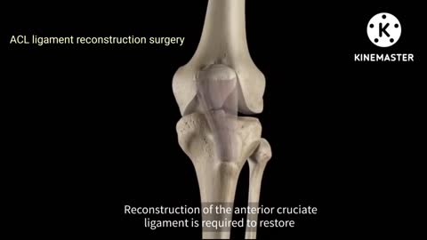 ACL Surgery