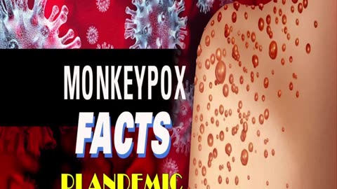 The Truth About The Monkey Pox (Mpox) Plandemic