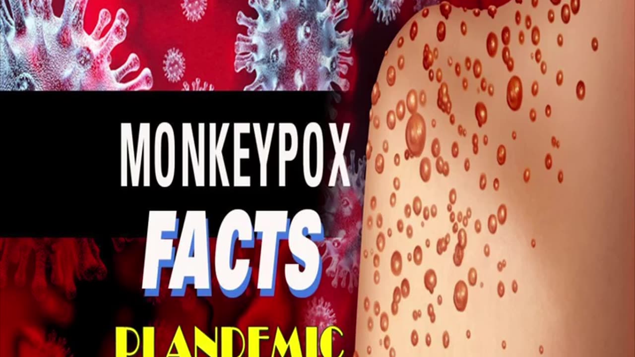 The Truth About The Monkey Pox (Mpox) Plandemic