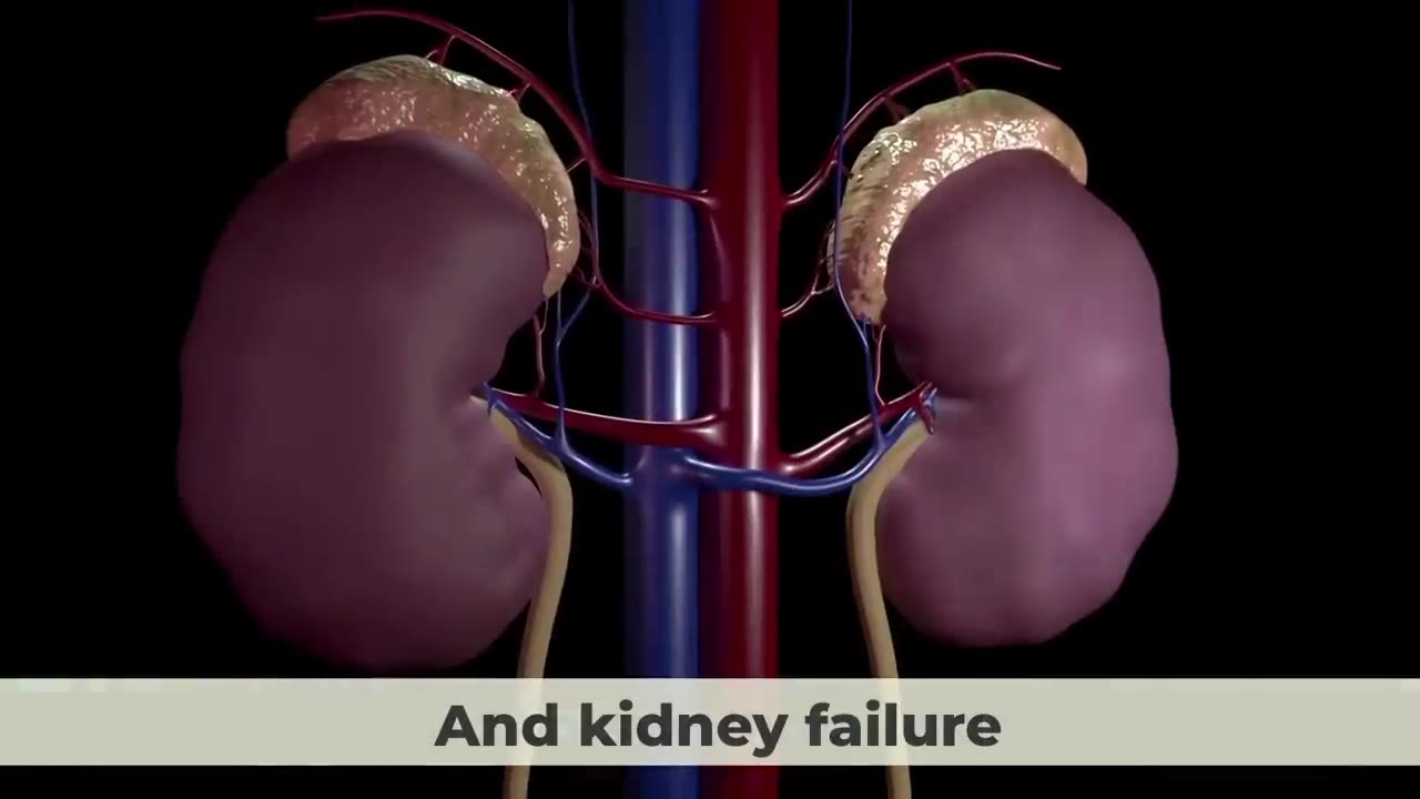 Kidney tips - 8 daily habits are destroying your kidneys