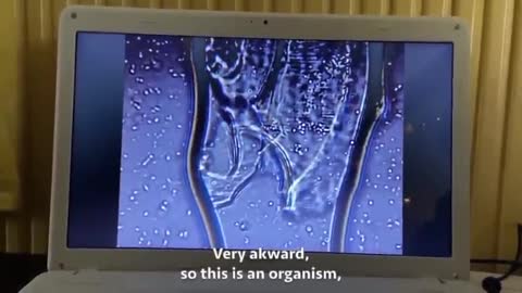 Pfizer Vaccine Living Organisms