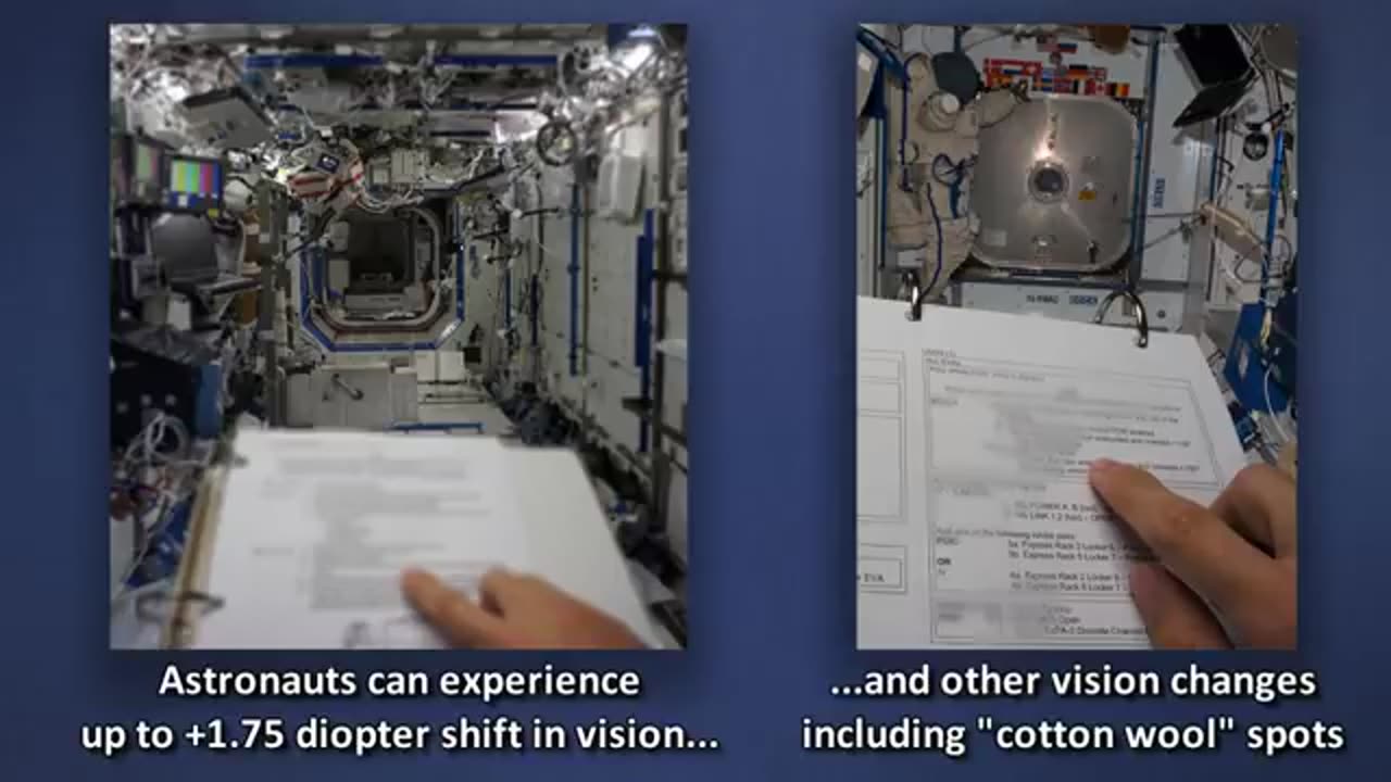 Astronaut Vision Changes in Microgravity