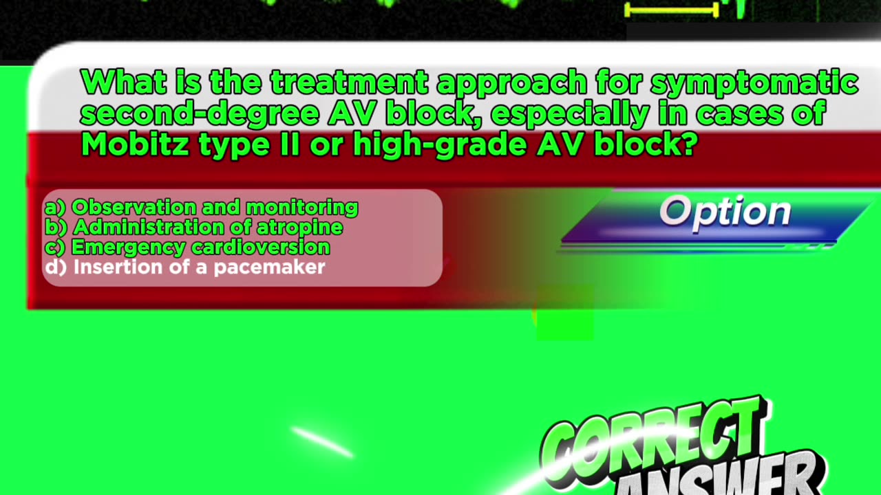 Second degree heart blockages #2nddegreeheartblock #arrthymias #CardiacArrhythmia