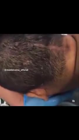 This dudes head is...leaking？ His head has sprung a leak？Thank you Pfizer