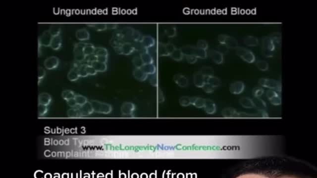 How grounding affects our blood