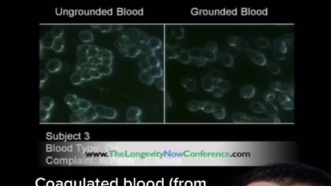 How grounding affects our blood