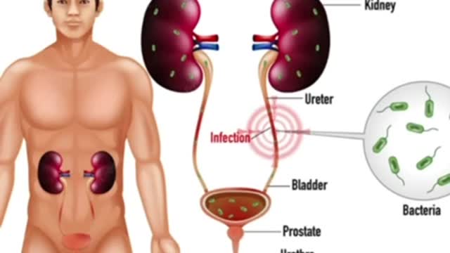 Urinary tract Infection