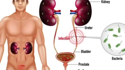 Urinary tract Infection