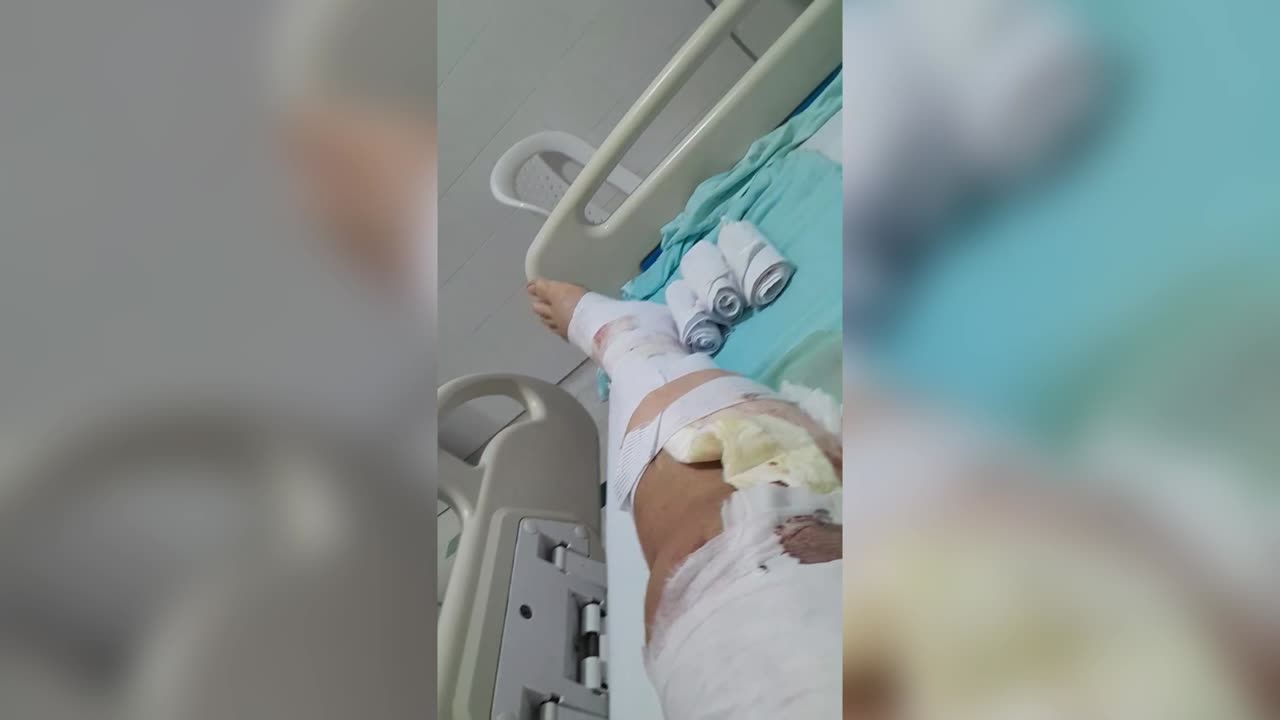 VIDEO: Joven herido en accidente de Lebrija requiere sangre