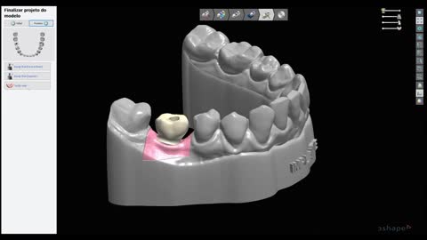 Simplificando a Odontologia Digital - Teaser