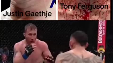 UFC