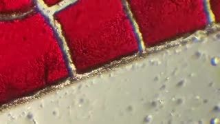 Not Jabbed. Why is my blood this way?