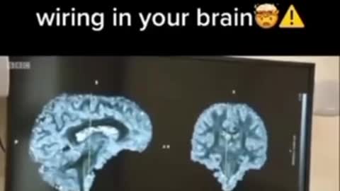 Processed foods rewire the brain.