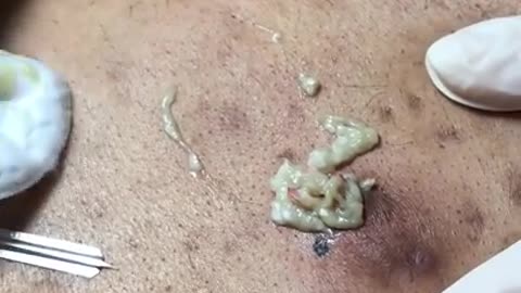 popping videos