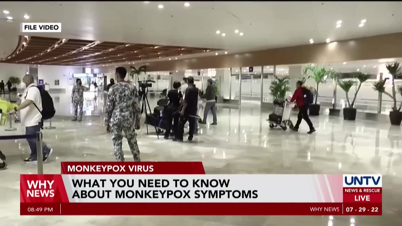 Monkeypox Symptoms you want to know