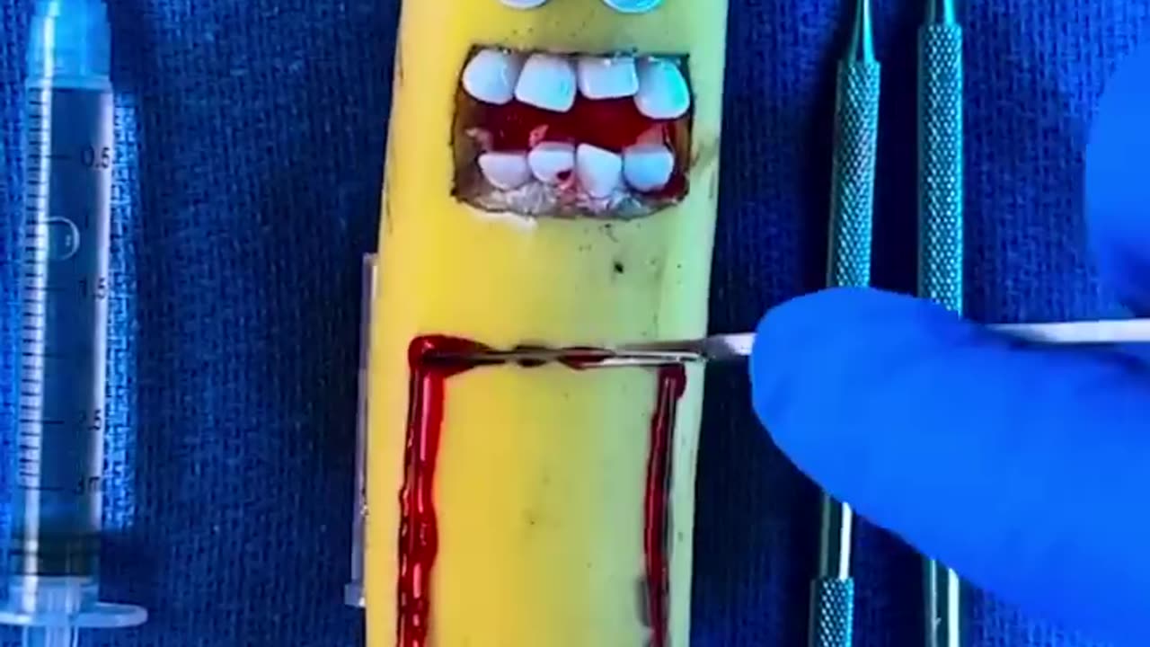 Emergency #FruitSurgery! Banana gives birth to twins 🥺🪦💔 #DiscountDentist #FoodSurgery #ASMR