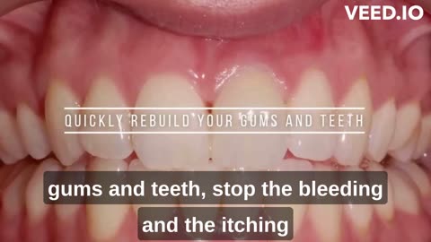 Let This Soft Mineral Melt In Your Mouth To Rebuild Gums and Teeth- Gums and Teeth solution