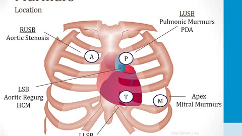 Cardiology - 5. Cardiac Auscultation - 1.Heart Murmurs