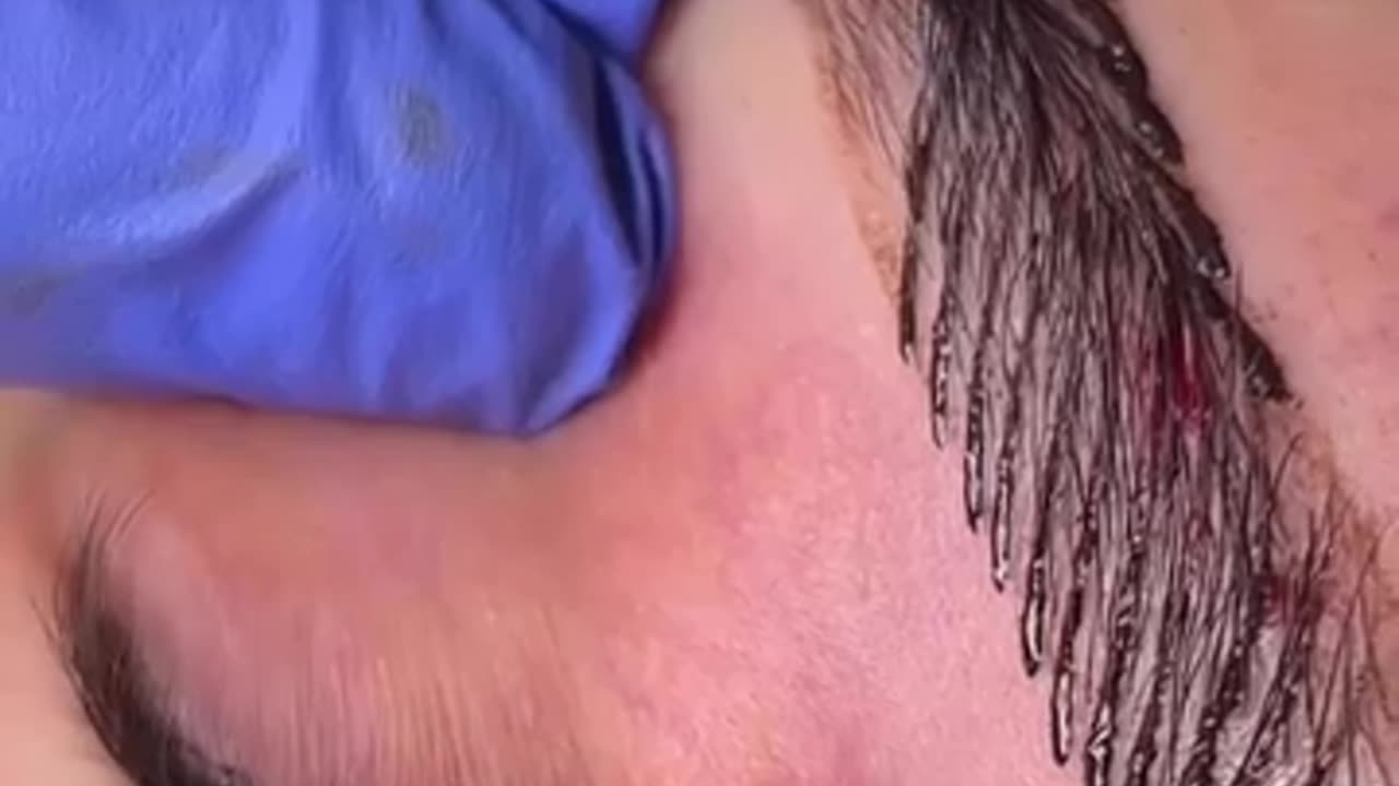 Eye brow