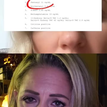 Golden Calf died of an overdose