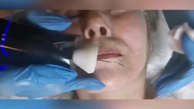 THE BEAUTYTECK DEVICE.mp4