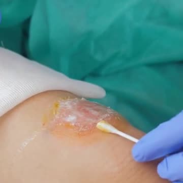 8 Benefits and Uses of Argan Oil