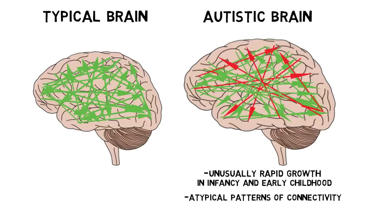 2-Minute Neuroscience: Autism