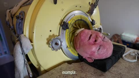 The Man in the Iron Lung